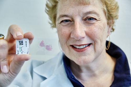 Laura van ‘t Veer in lab at Agendia Amsterdam
